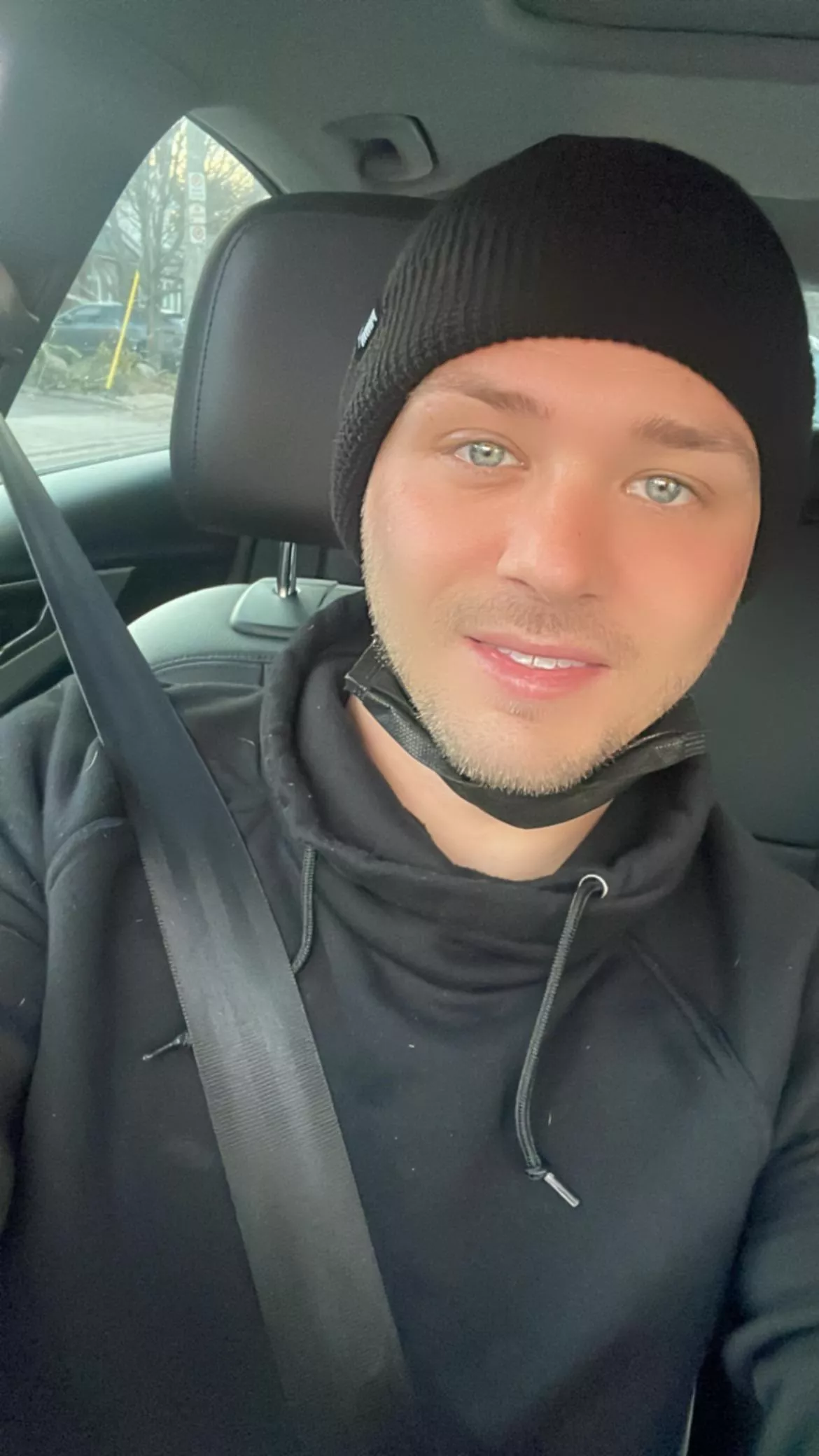 1 week after Nose surgery! Gunna miss all the time spent gayming when I go back to work 😪