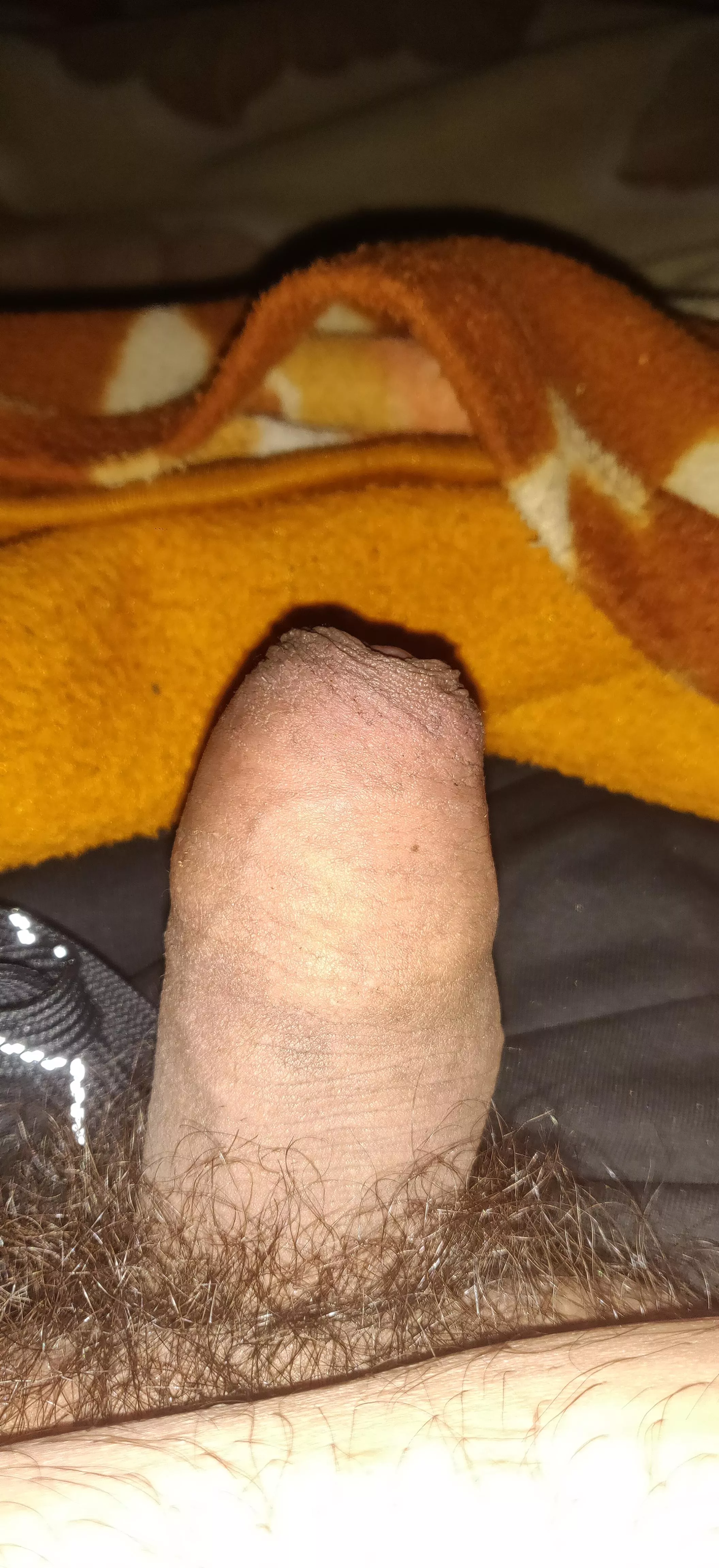 (18) dms are open