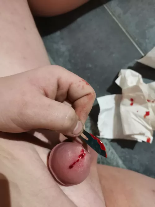 [19] beated him today