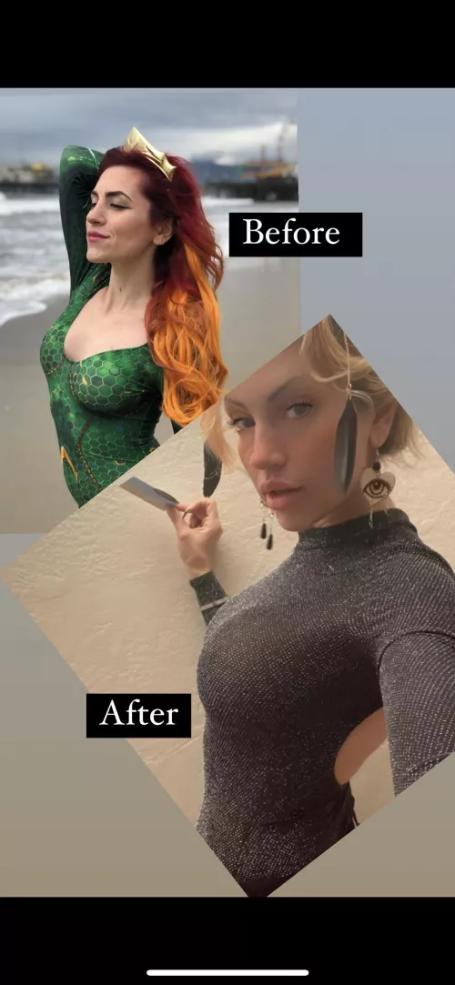 2 surgeries and 5 different procedures to get this look today :) currently 520 cc implants now 6 weeks old!