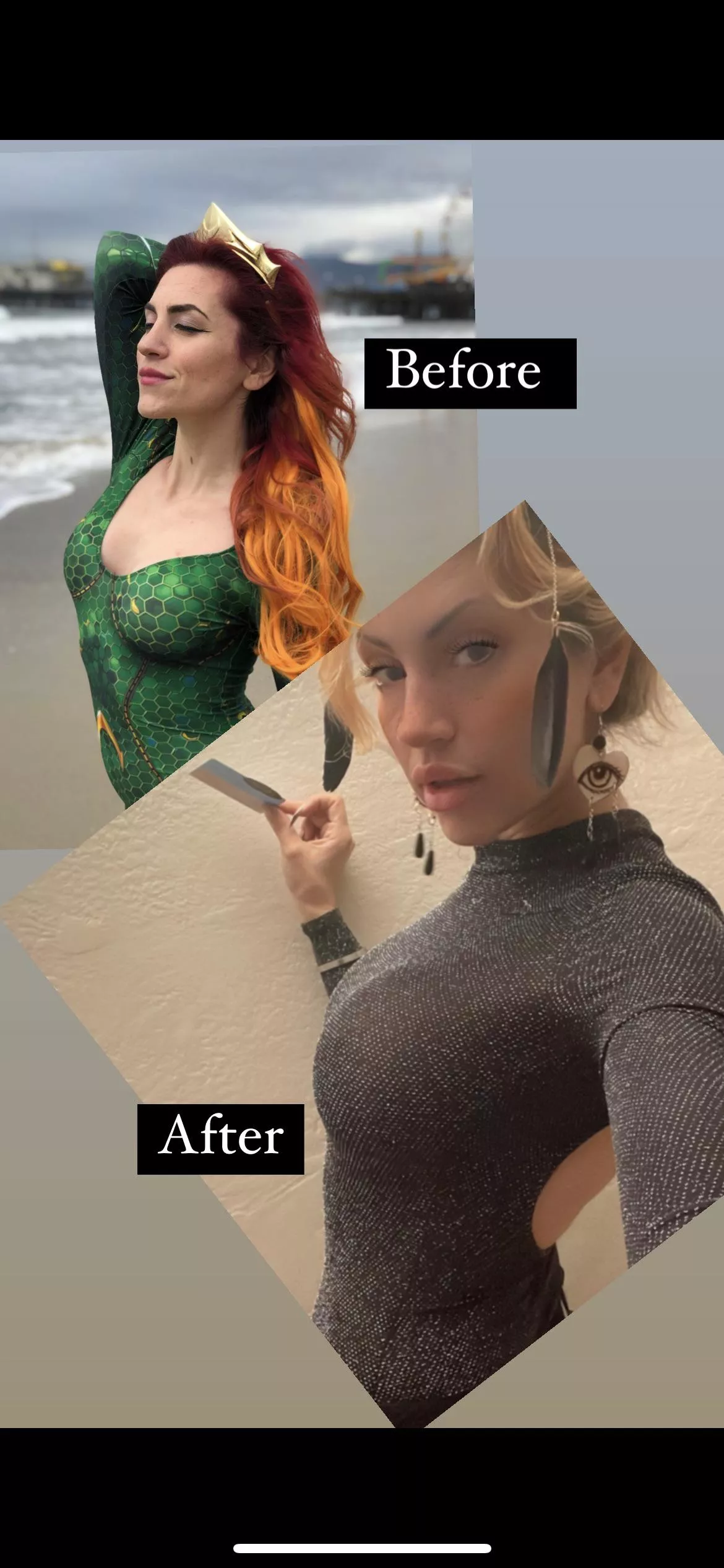 2 surgeries and 5 different procedures to get this look today :) currently 520 cc implants now 6 weeks old!