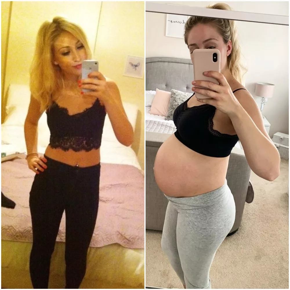 20 vs 25 and pregnant