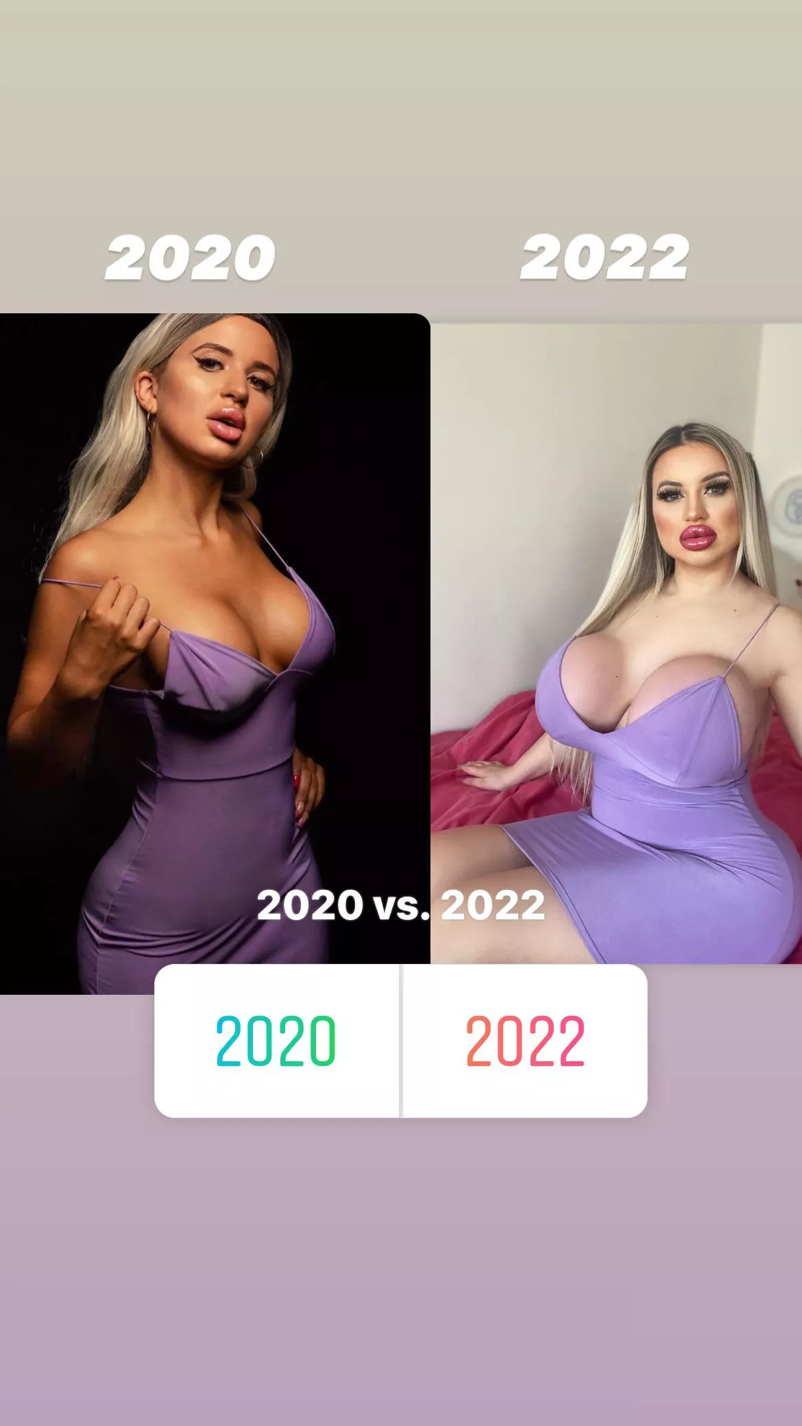 2020 vs. 2022 2020 vs. 2022