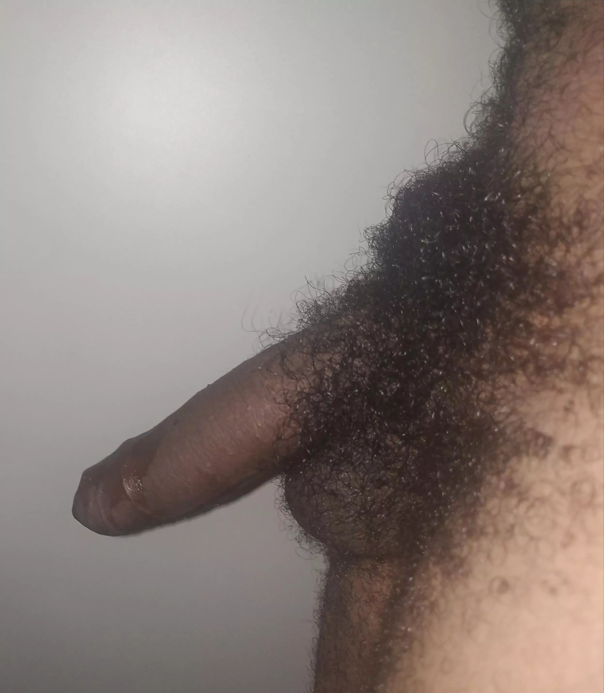 20y, dm open