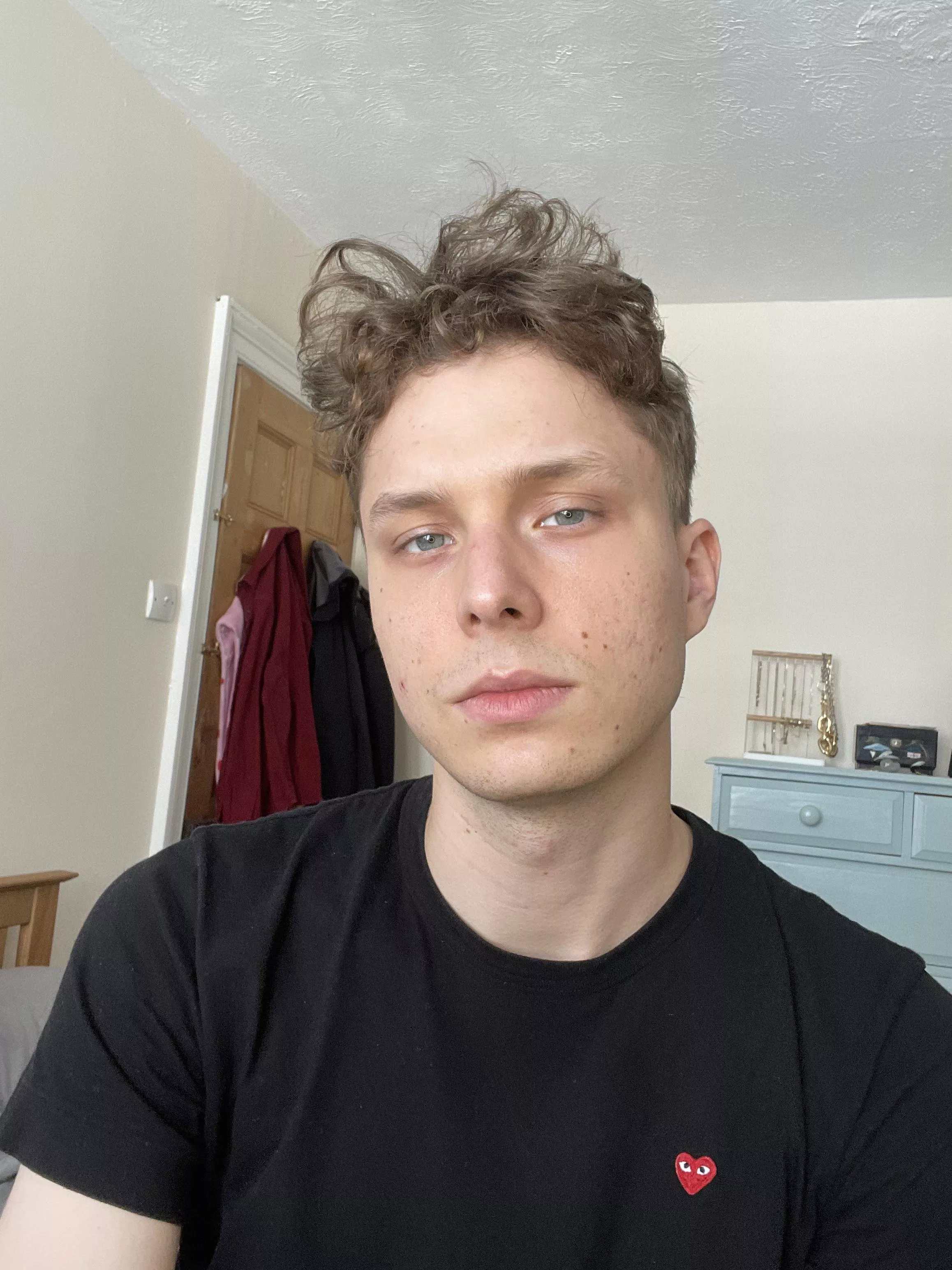 [22] Been told I have a nice chin. What you think? 😉