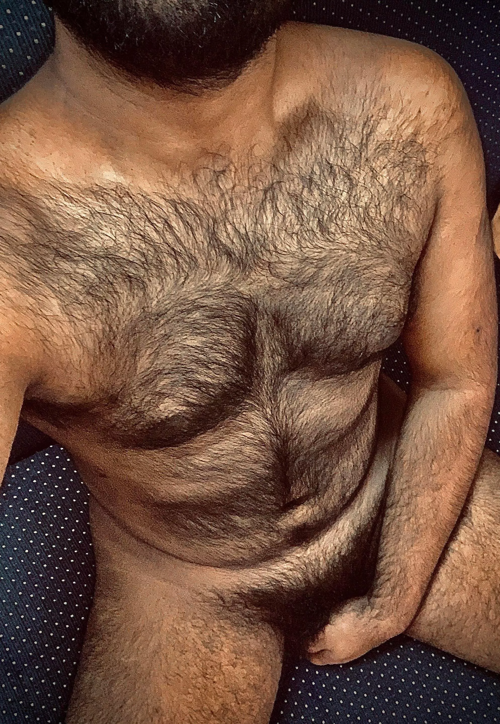 25m I have been insecure about my hairy body for a very long time now 25m I have been insecure about my hairy body for a very long time now