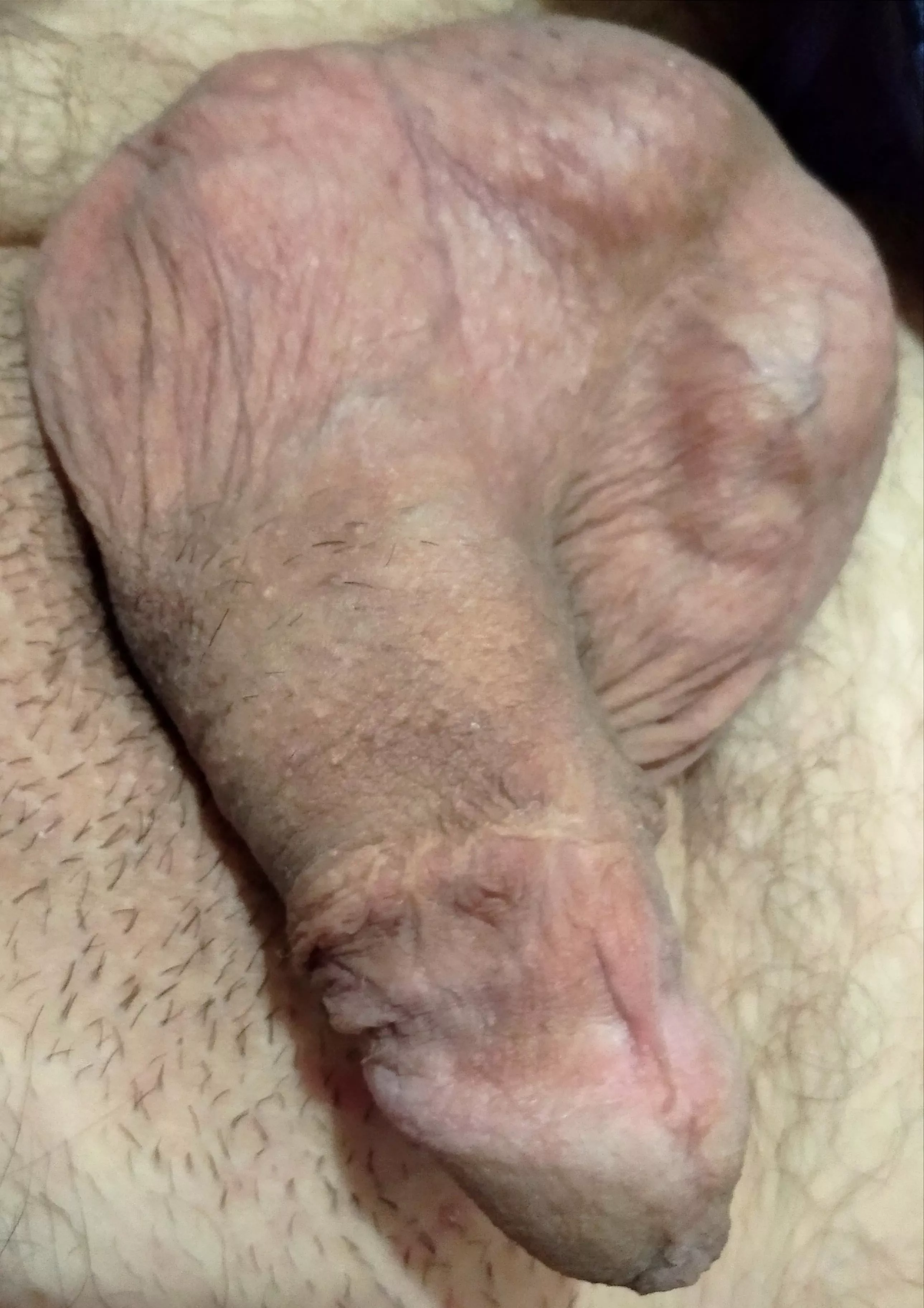 [26] I want to count how many of you have looked at my soft cock. So upvote if you did.