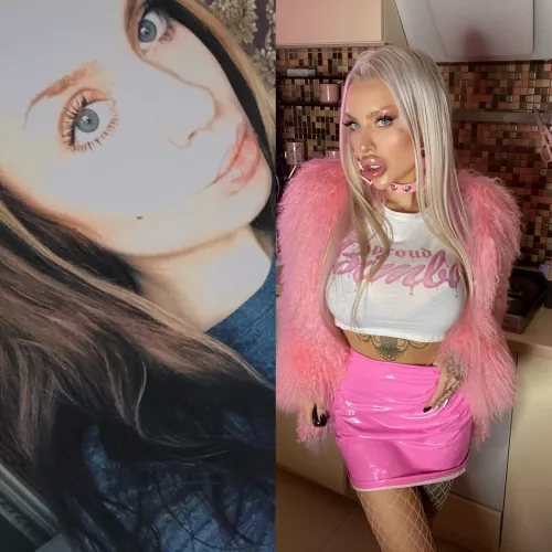 4 surgerys, full face fillers, 16cc lip fillers. Tattoos, piercings. New mind and look at this life. I’m happy, as never before ✨💕 I’ll continue. I’m not even close to my goal. 1010cc boobs is waiting! New fillers booked in February.