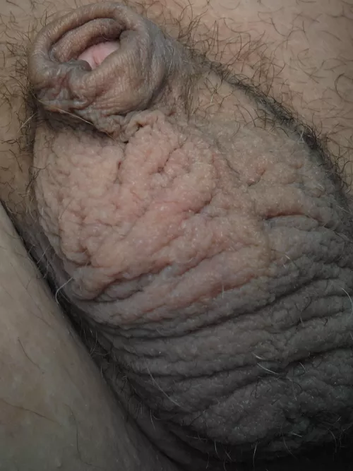 [43] so cold, need somewhere warm to stick him