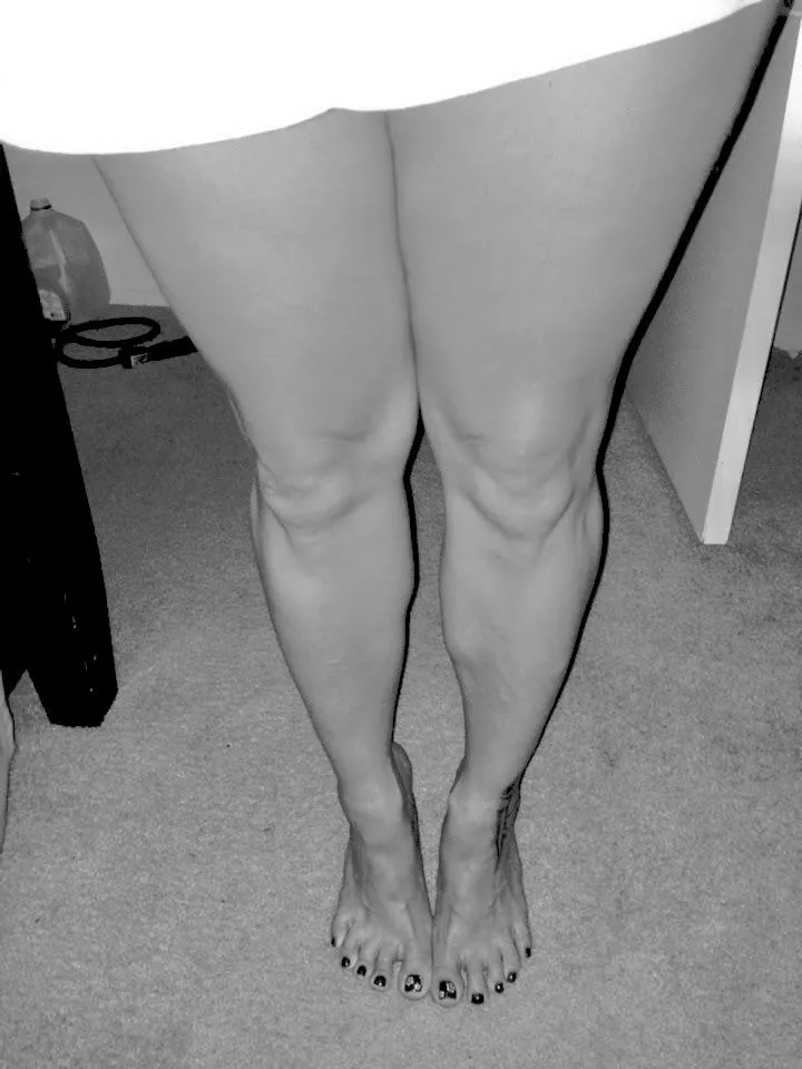 50 yo married milf, gilf black n white legs n toe spread for y’all.