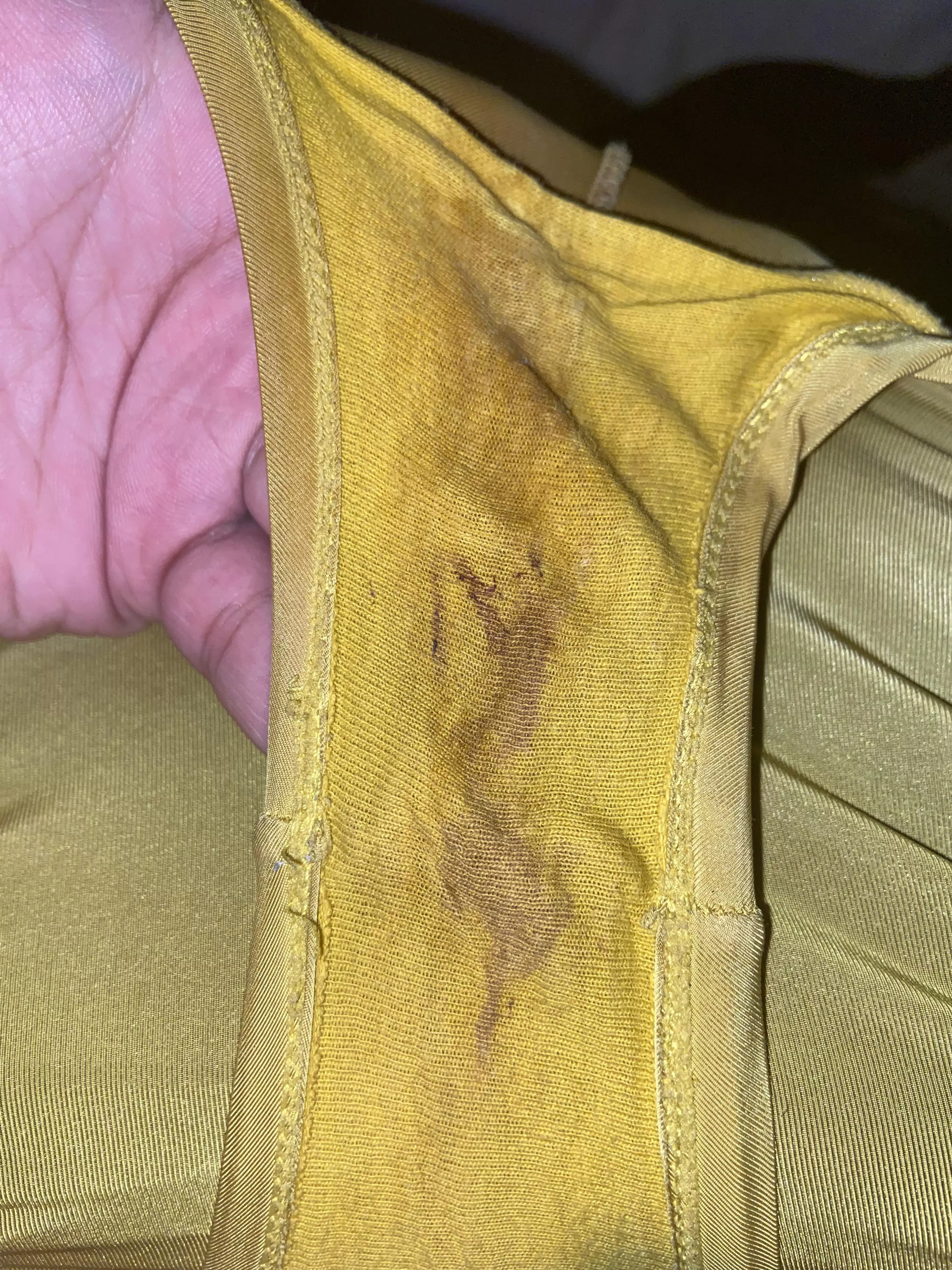 A little bit of Spotting 🤭🩸