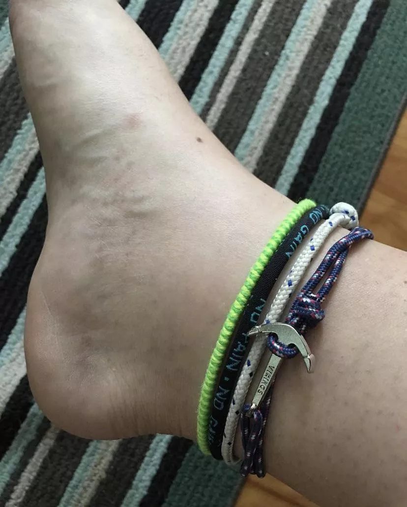 A little closeup of my foot 😉