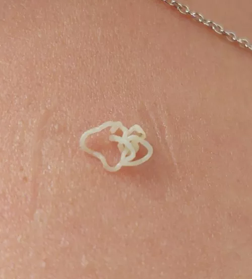 A little thing on my wife's shoulder.