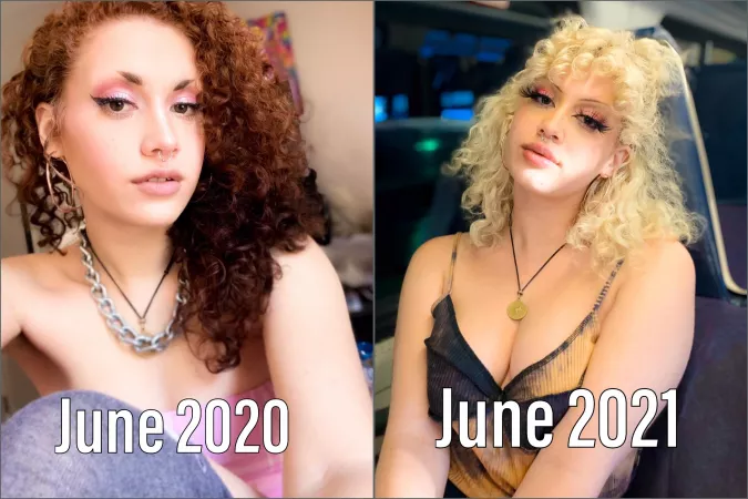 A year of difference π hair, lips, and botox! Already have an appointment for another ml of filler for my lips