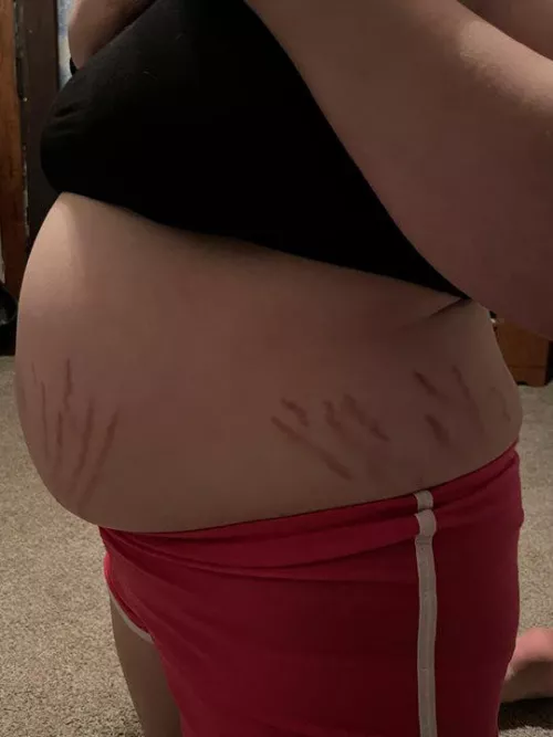 About to burst! 💥💥