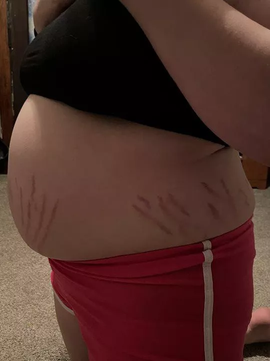 About to burst! 💥💥