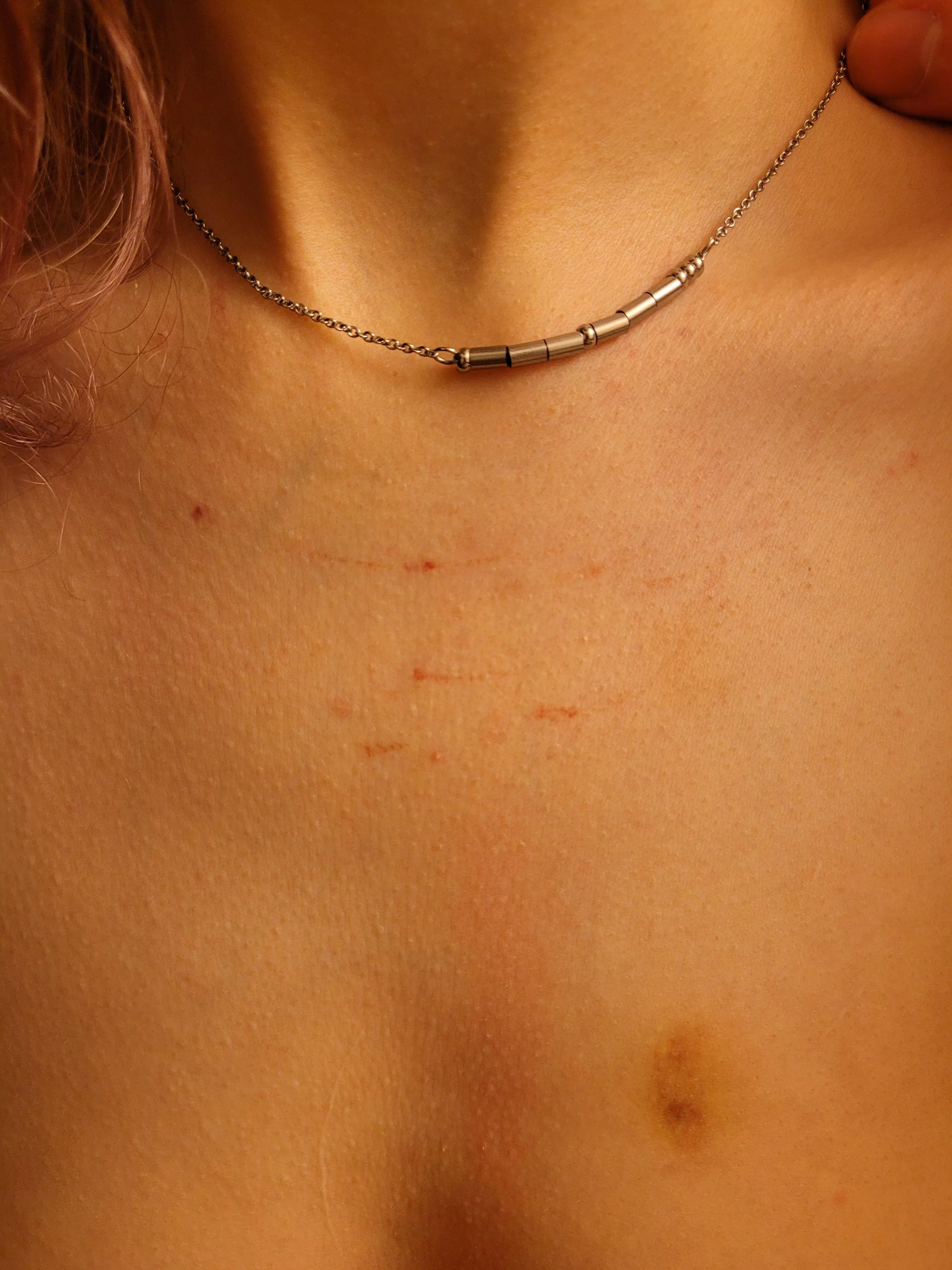 After a very rough play session with Sir, my collar left marks on my skin without either of us knowing until after, what a lovely surprise 🤤