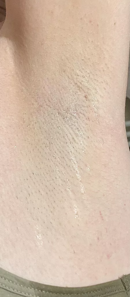 After a walk in the sun this is how I came home 🙊