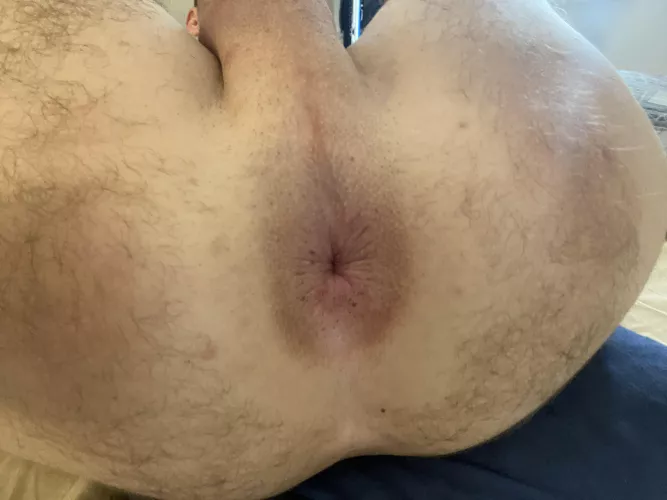 After an hour of rough stretching my hole stil looks kind of normal…right?