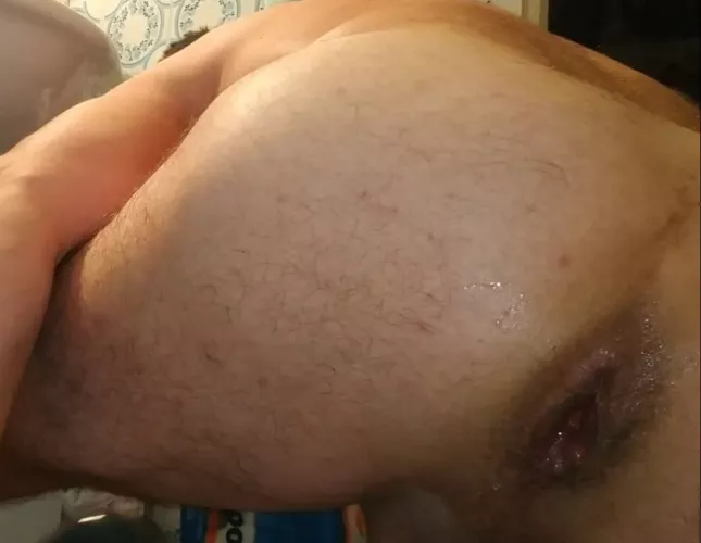 after gape
