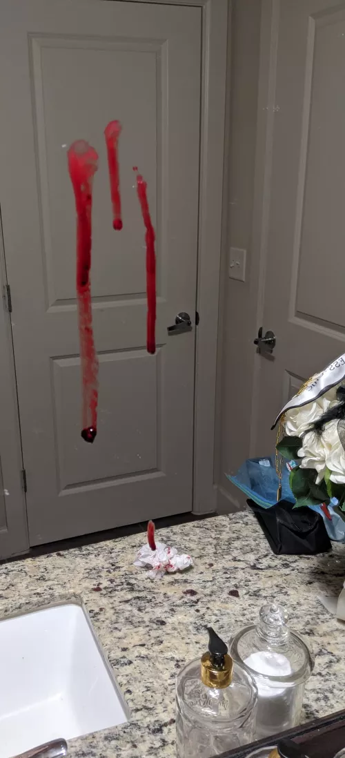 After math of a hematoma by my ear.