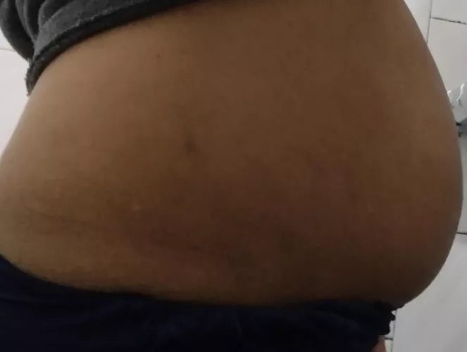 after my pregnancy I ended up with a belly like this