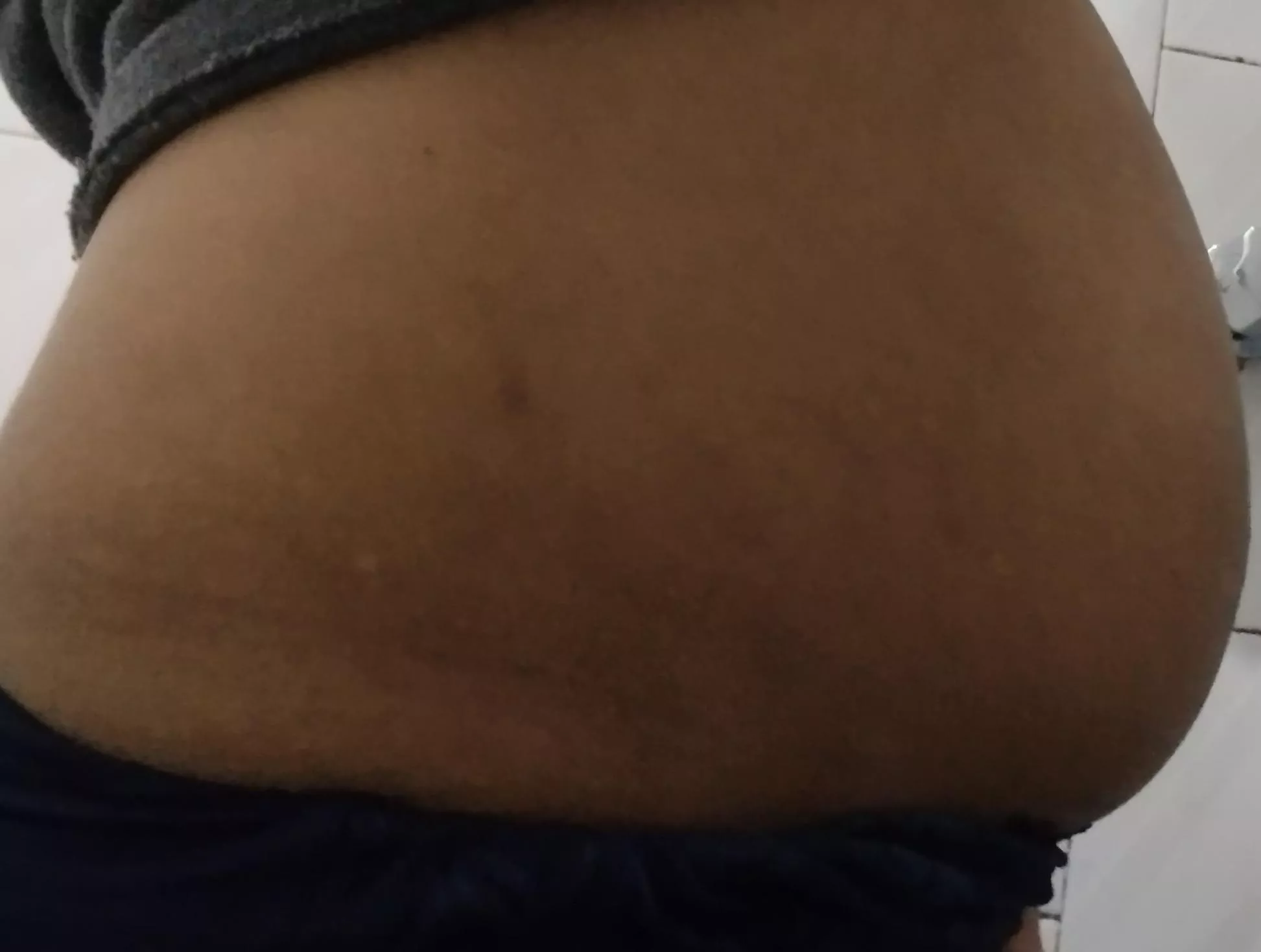 after my pregnancy I ended up with a belly like this