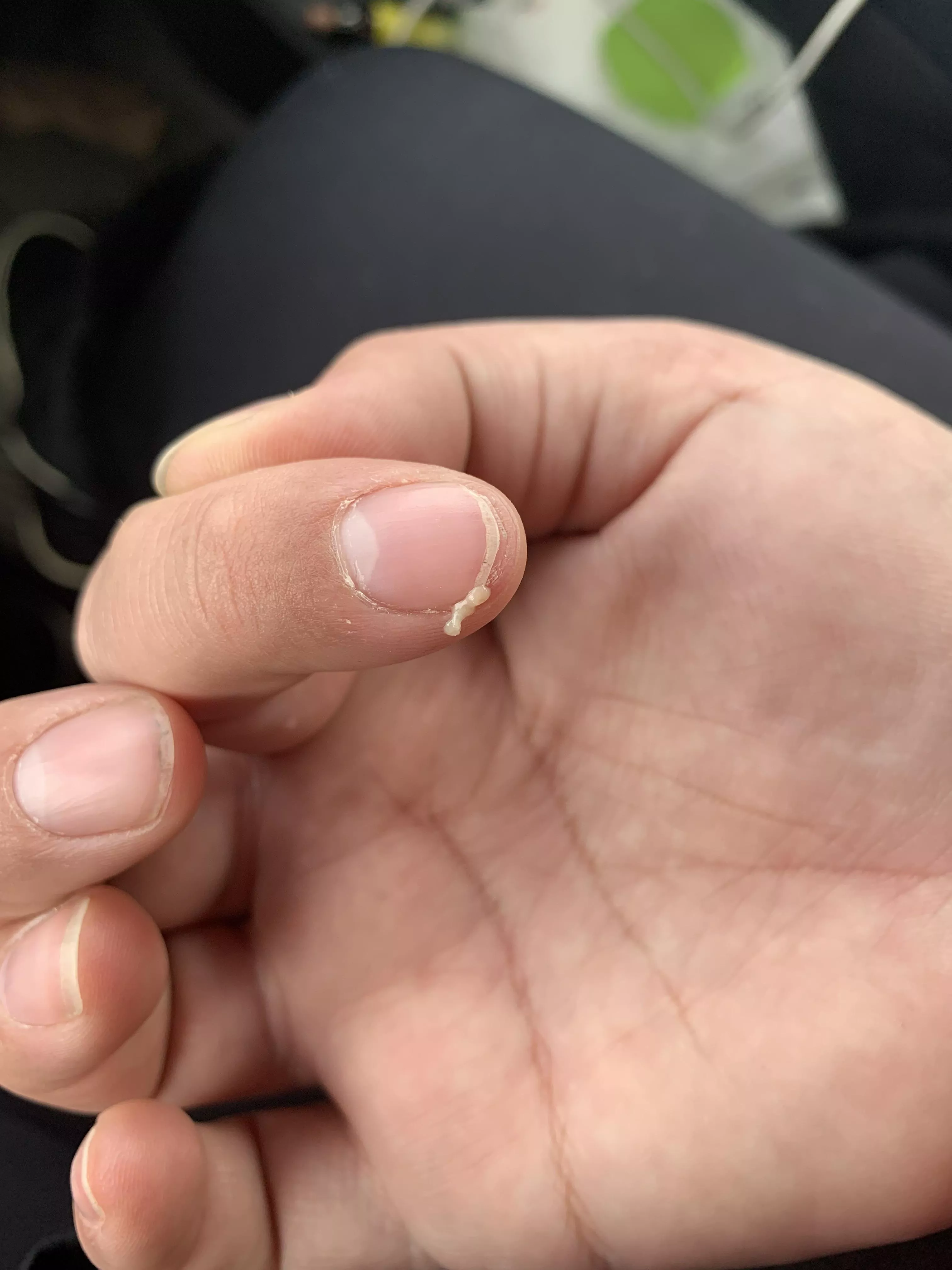 Aftermath of face pimple