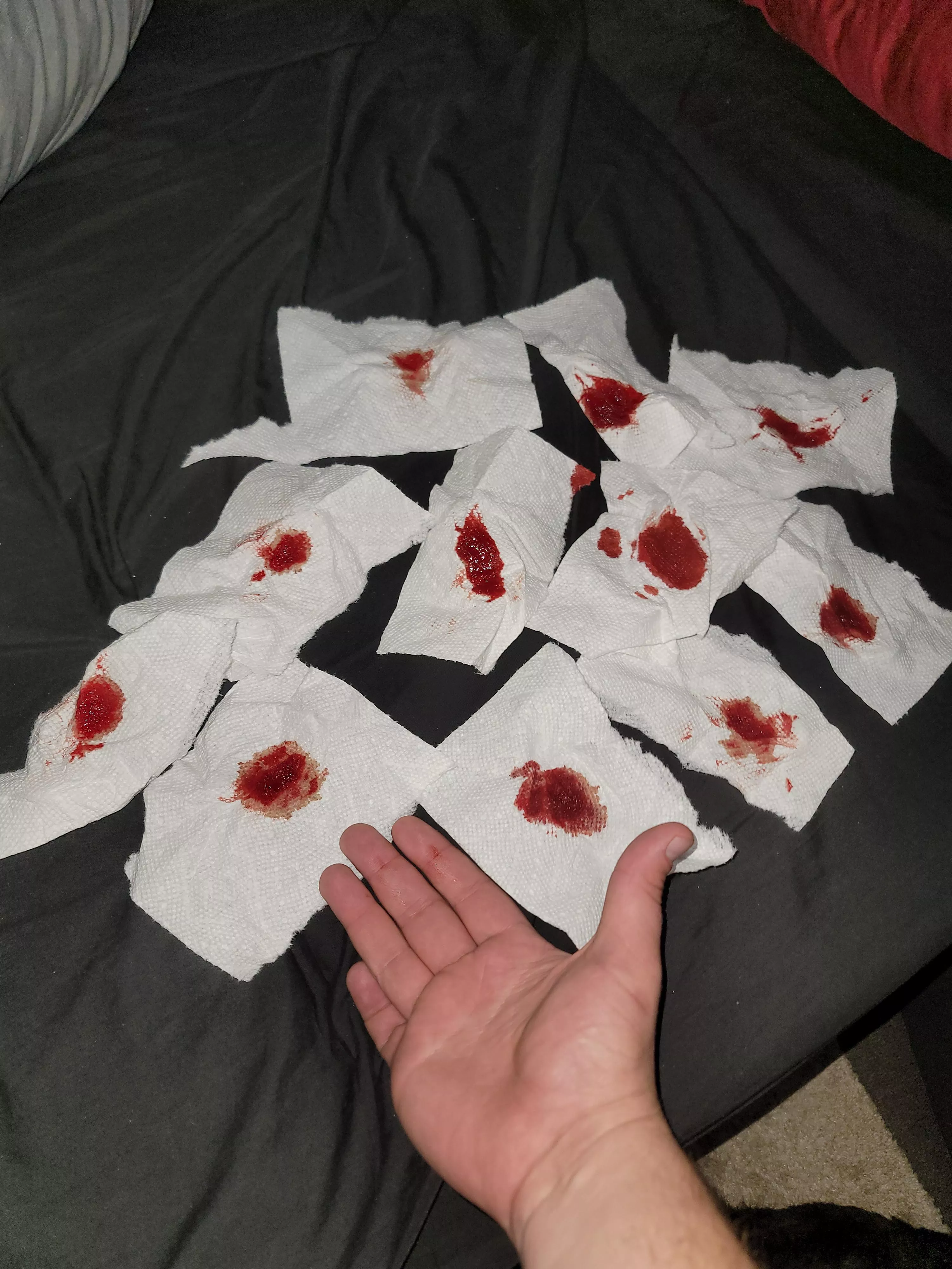 All the blood from a cyst on my ass. It popped a couple weeks ago too and the blood was running down my leg and dripping on the floor. I've never seen so much blood come out of me. Hand for scale