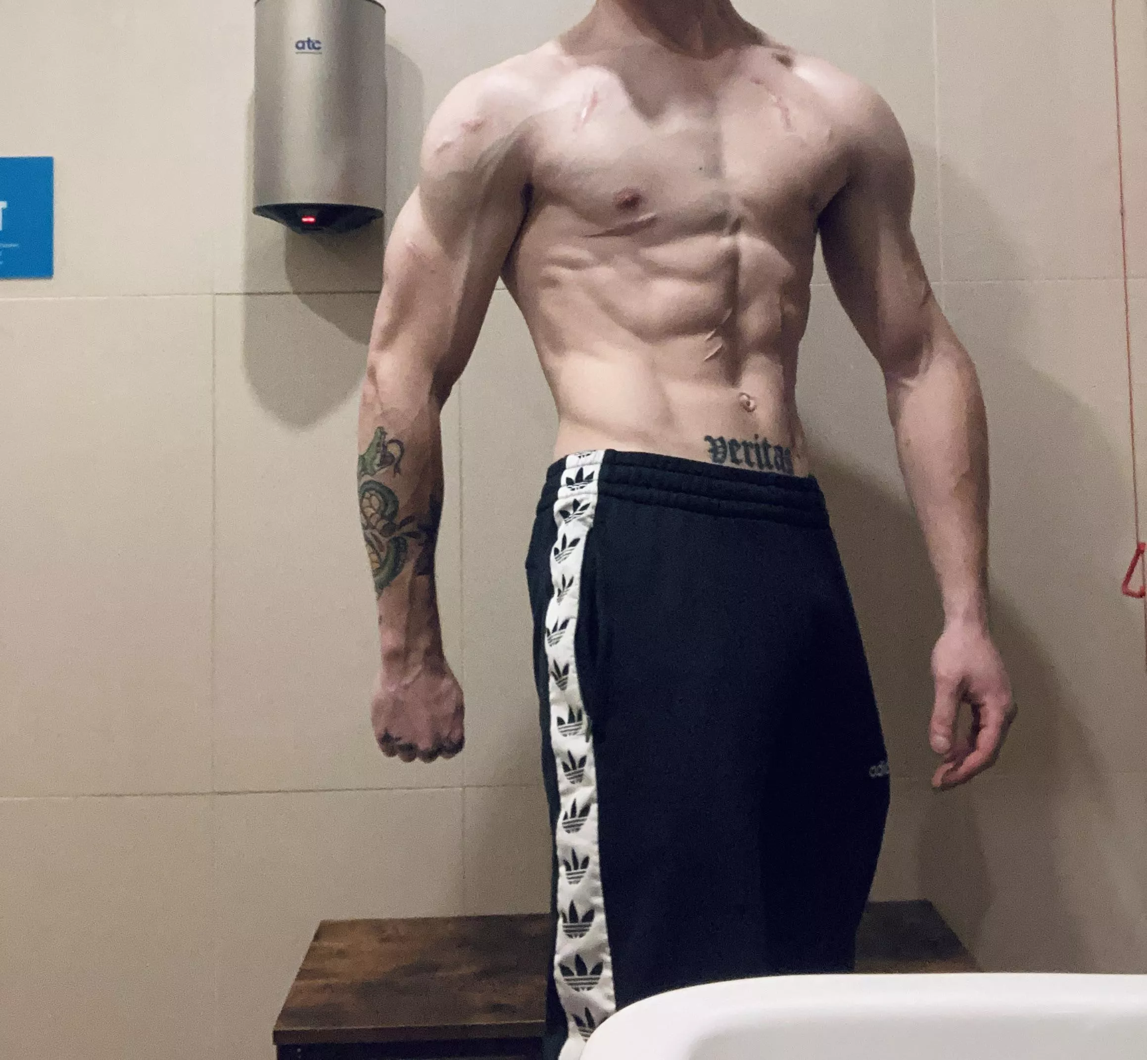 Also got another on my back!