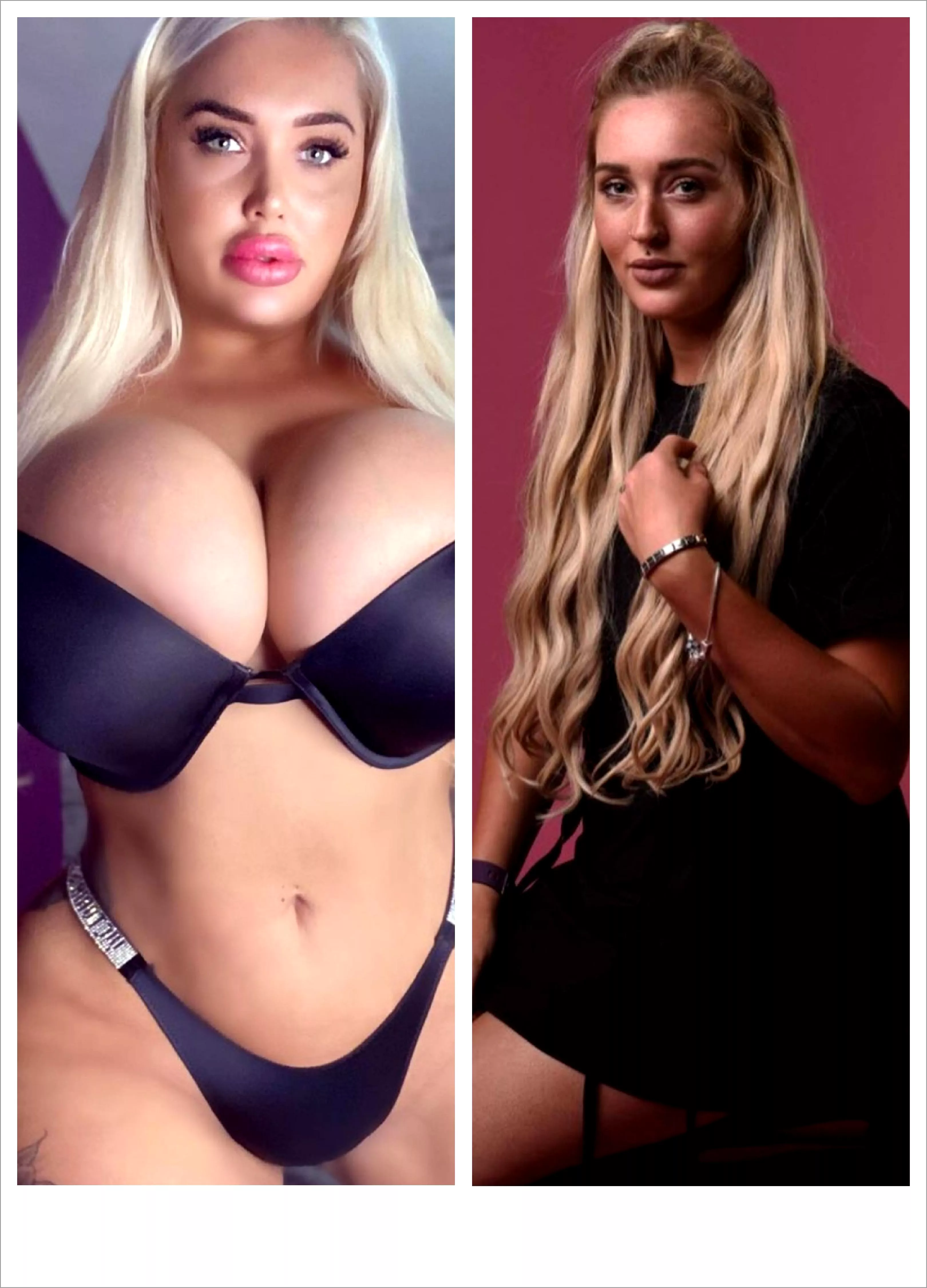 Amber Mwy rapid progression