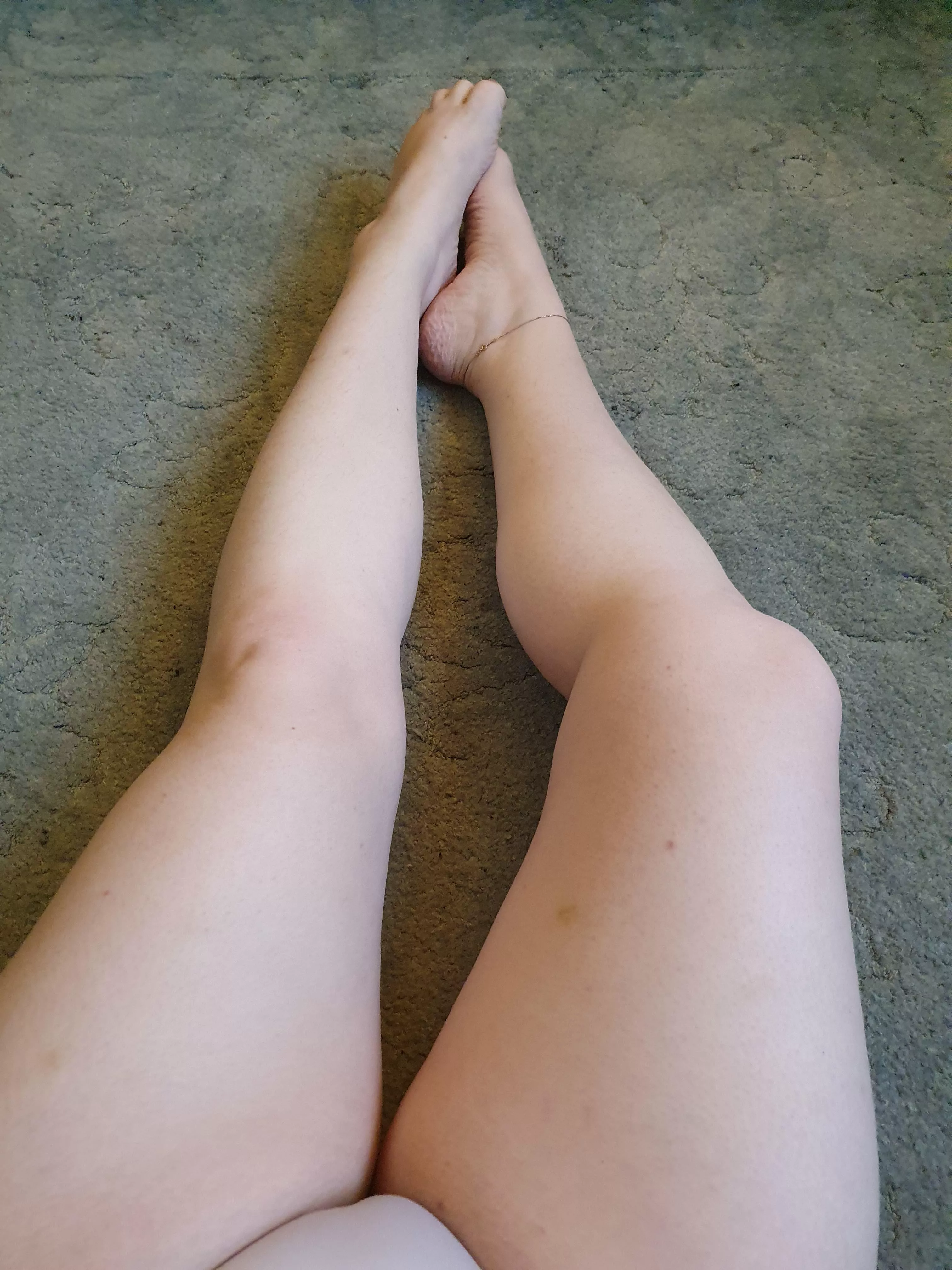 Anklets and bruises make wonderful accessories!