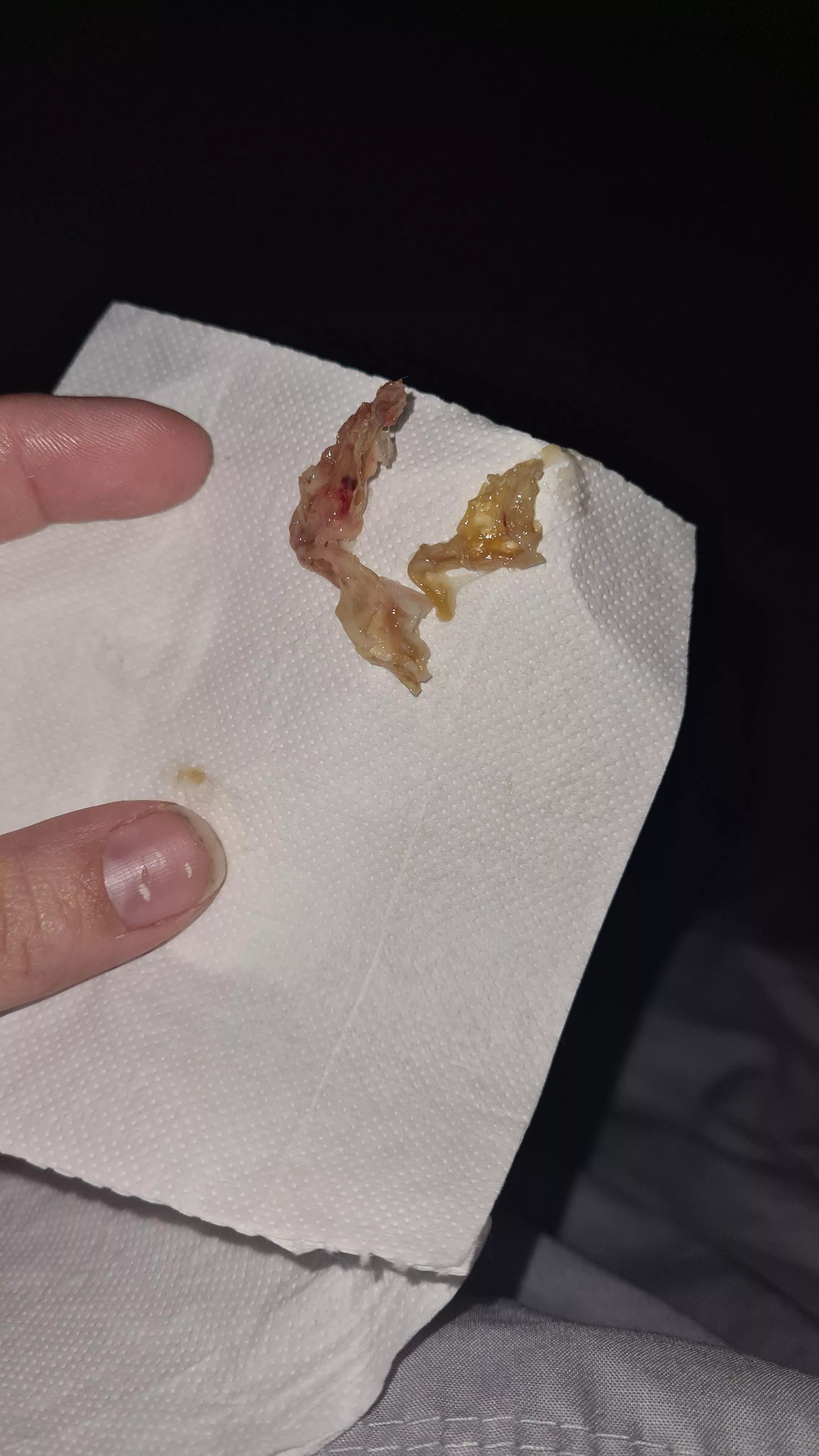 Another juicy nose blow last night