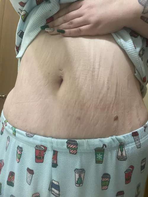 Any love for stretch mark speckled mommy bellies?
