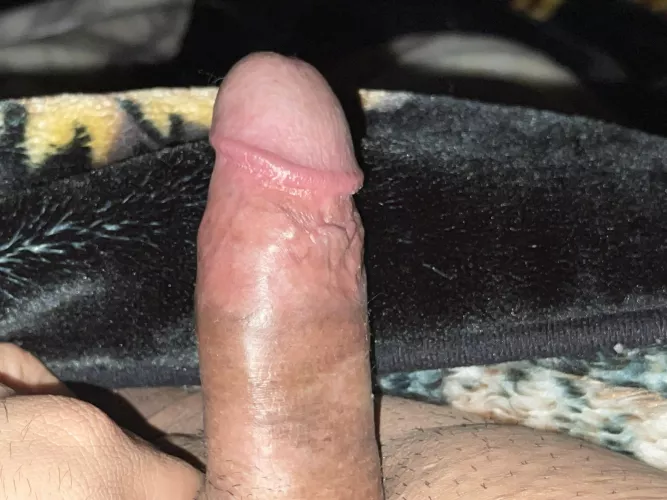 Any takers (m)(36)