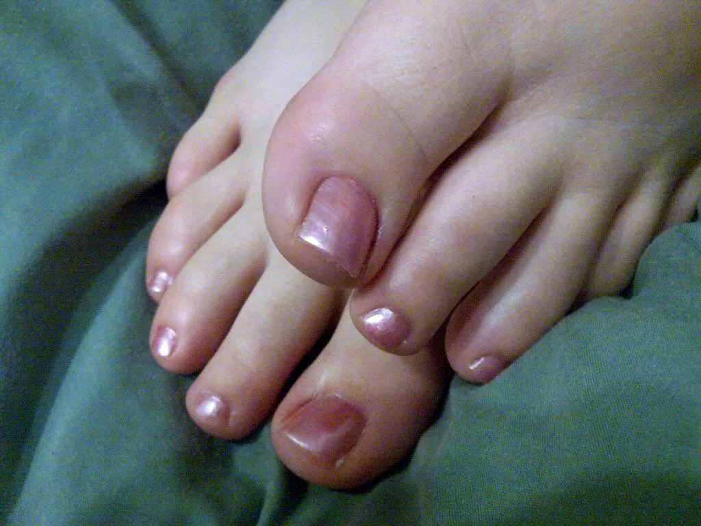 Anyone keen for a serve of my wife’s sexy little toes? 😍🤤😋 Anyone keen for a serve of my wife’s sexy little toes? 😍🤤😋