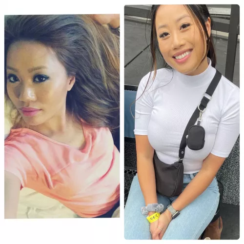 Asian breast growth 32A to 32F