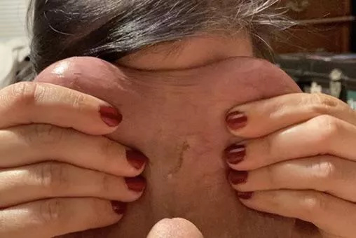 Balls so big they cover my whole face? Yes, please!!!