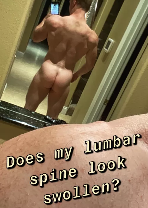 Been hitting squats hard and now my lu(m)bar spine is killing me.