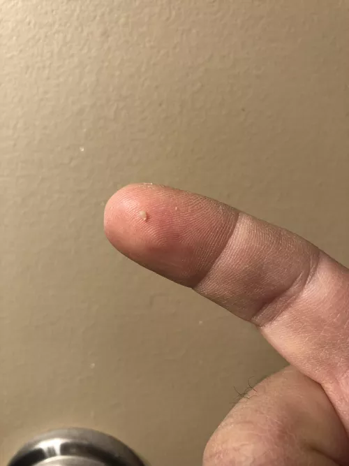 Been inside my nostril for weeks. I couldn’t take it anymore. Practically had to turn my nose inside out to get it.