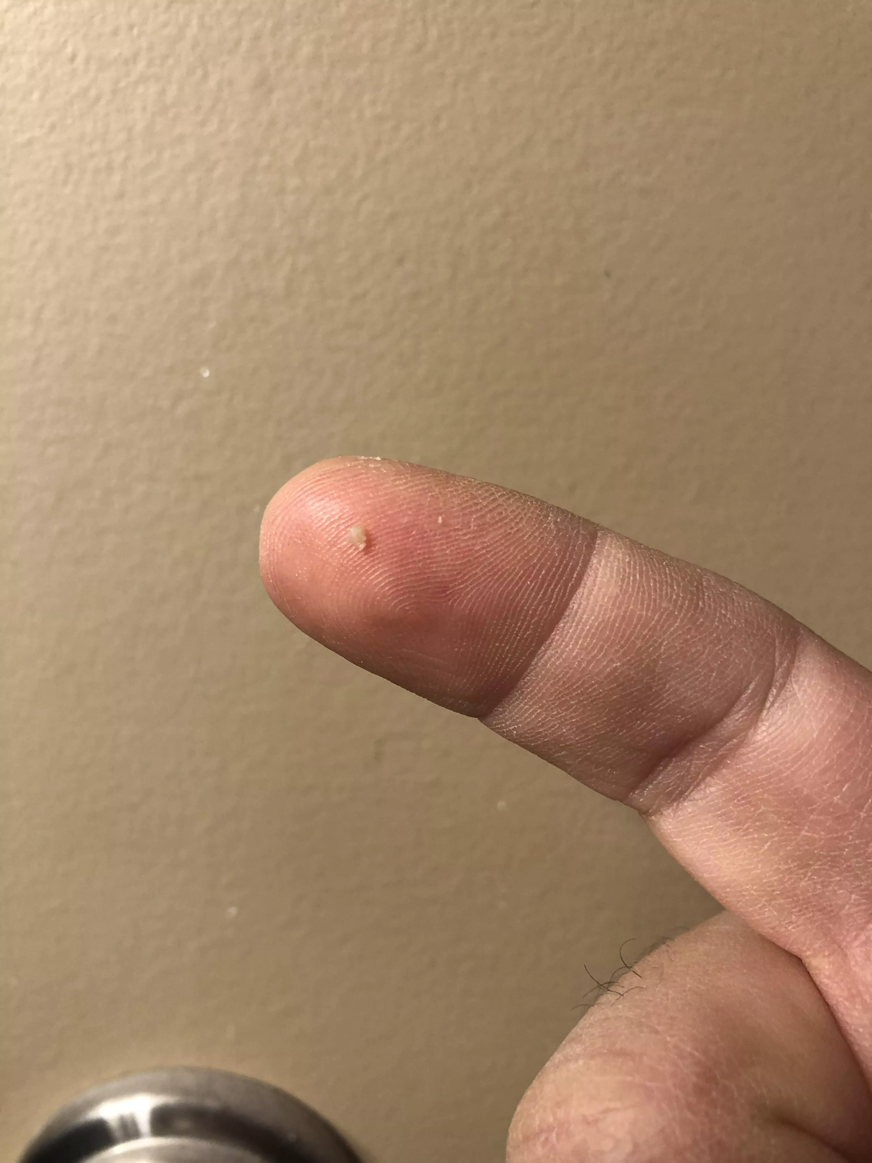 Been inside my nostril for weeks. I couldn’t take it anymore. Practically had to turn my nose inside out to get it.