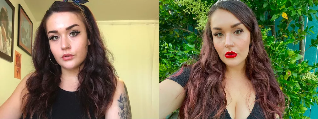 Before & after 40 units of Botox in my jaw 🤩 1st round of lip filler to come in the next month or so! Before & after 40 units of Botox in my jaw 🤩 1st round of lip filler to come in the next month or so!