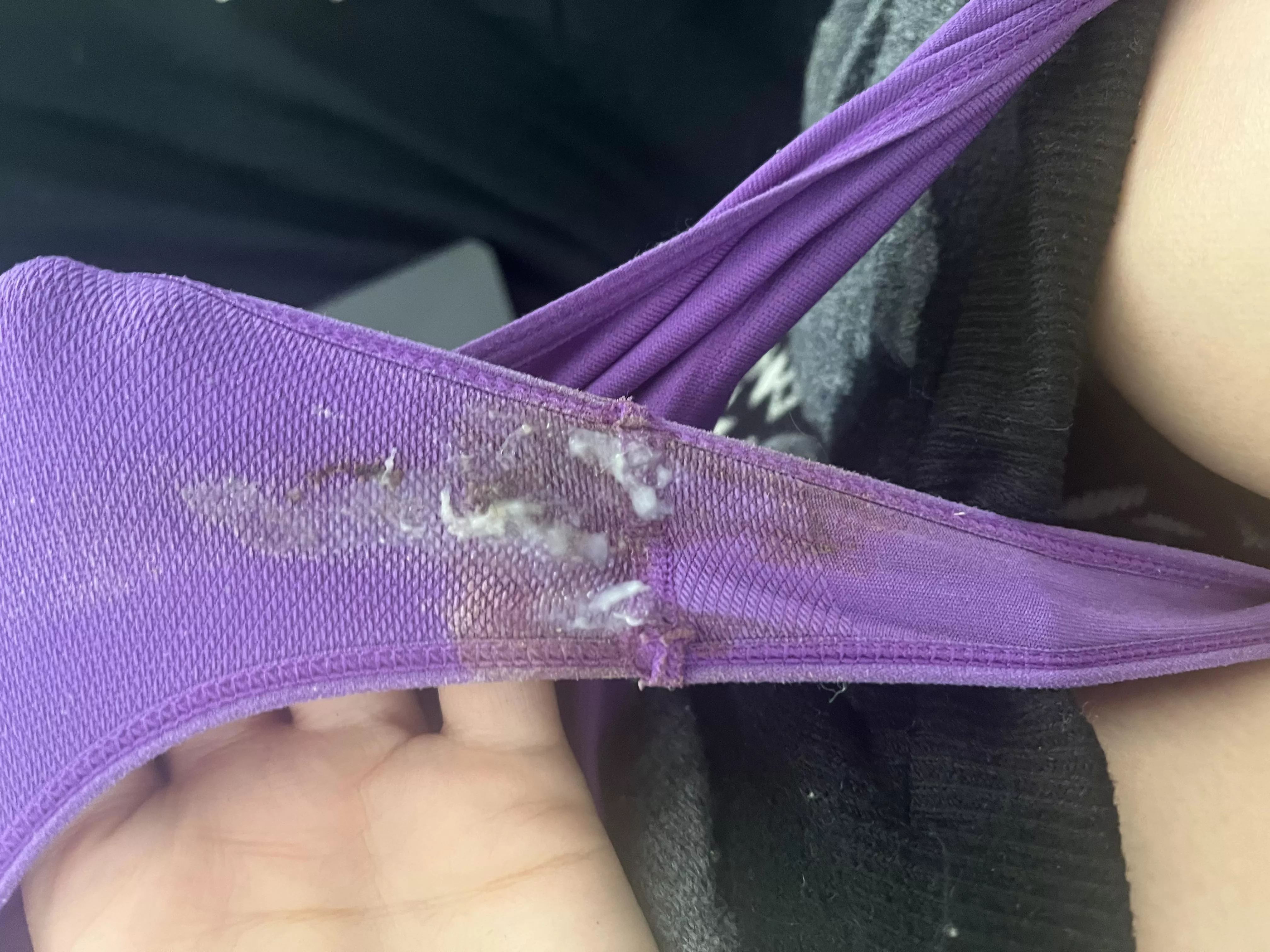 Before period it is mixed