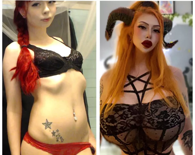 Before vs After - 750cc implants, lip and chin fillers, BBL