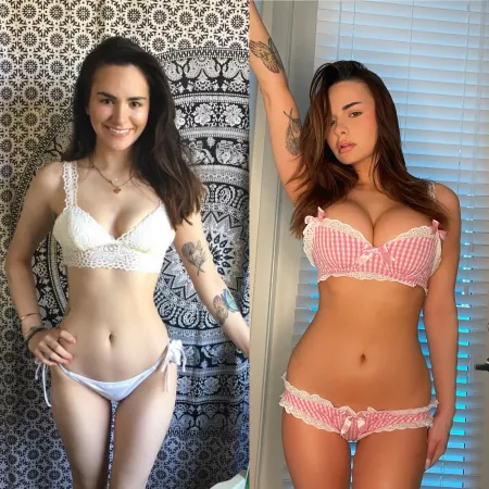 before was me battling bulimia and anorexia and now i’m bimbo with recovery 😁💘💗