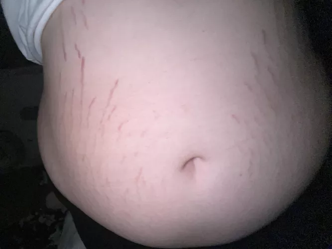 Big belly who