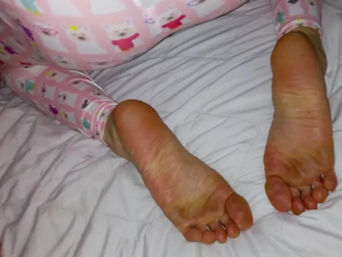 Big Feets 😄💅👣❤️