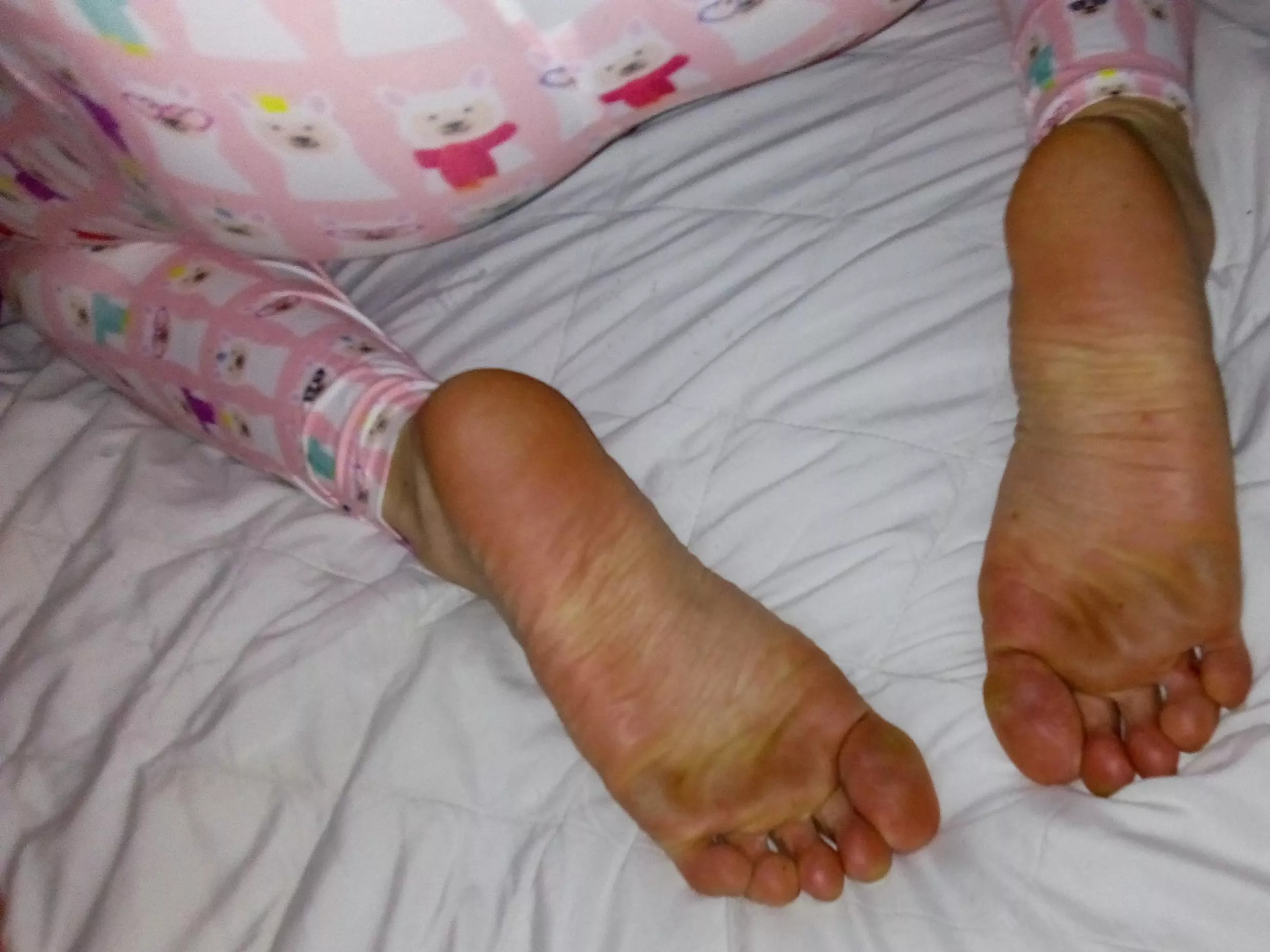 Big Feets 😄💅👣❤️