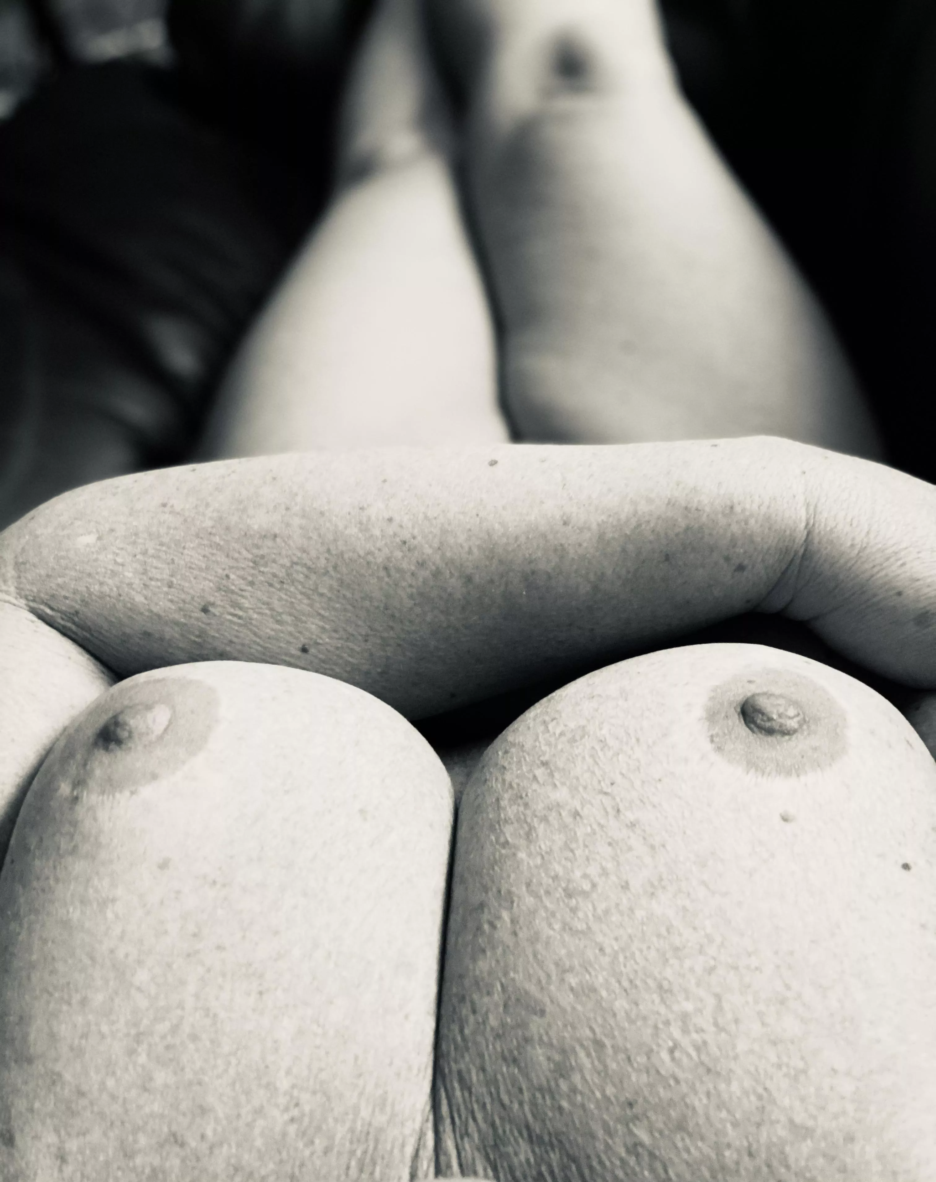 Black and white doesn’t hide my freckles (f)51