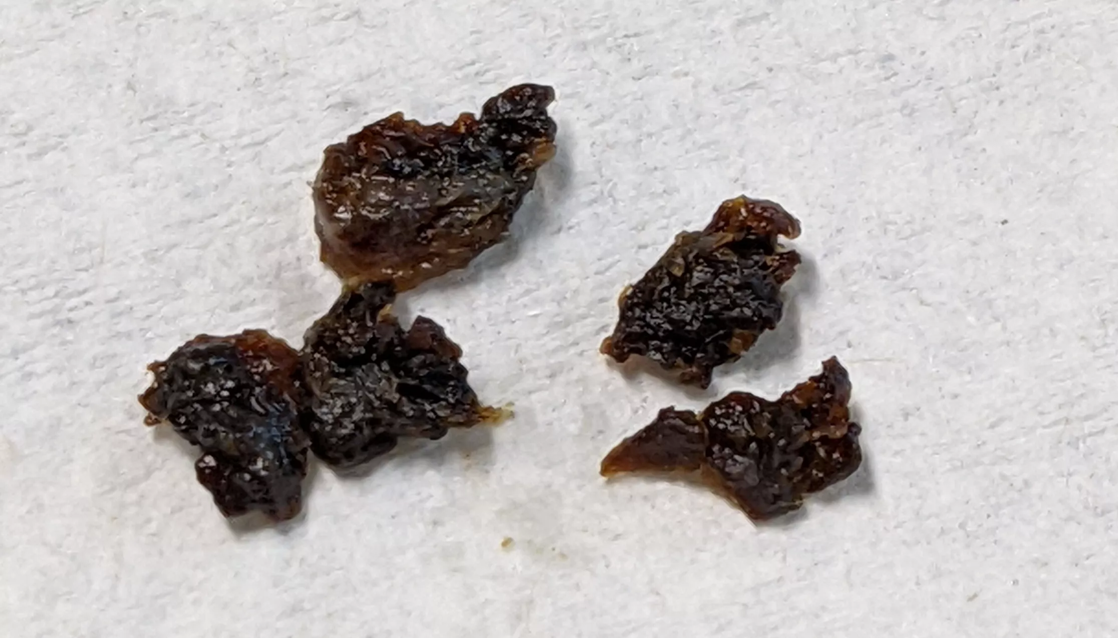 Both ears were full of wax, went to a specialist to get them cleaned out. This was all from the ear with the least severe blockage.